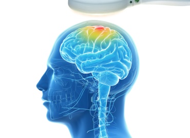 Συχνές Ερωτήσεις σχετικά με την θεραπεία διακρανιακής μαγνητικής διέγερσης (rTMS)