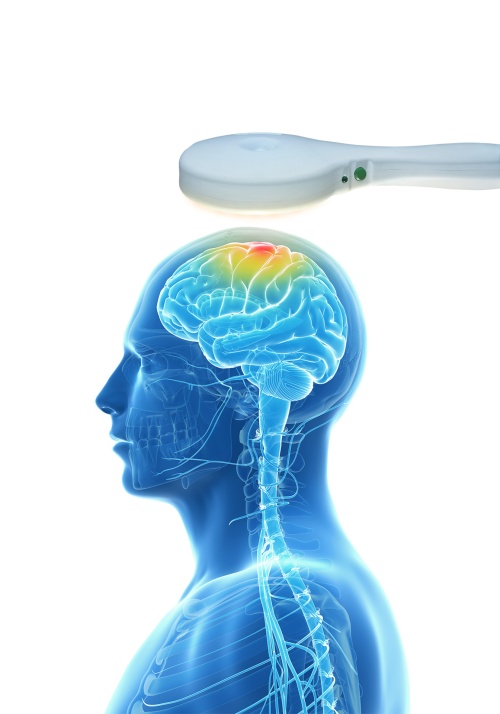 Συχνές Ερωτήσεις σχετικά με την θεραπεία διακρανιακής μαγνητικής διέγερσης (rTMS)